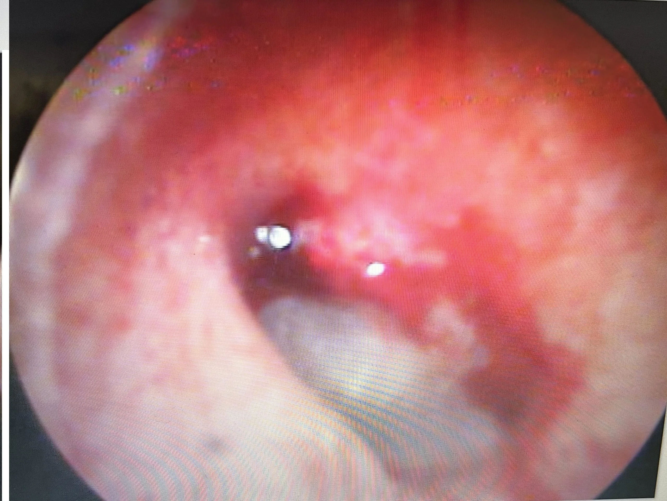 ent clinic near me, best ent, reviews cockroach and ear damage