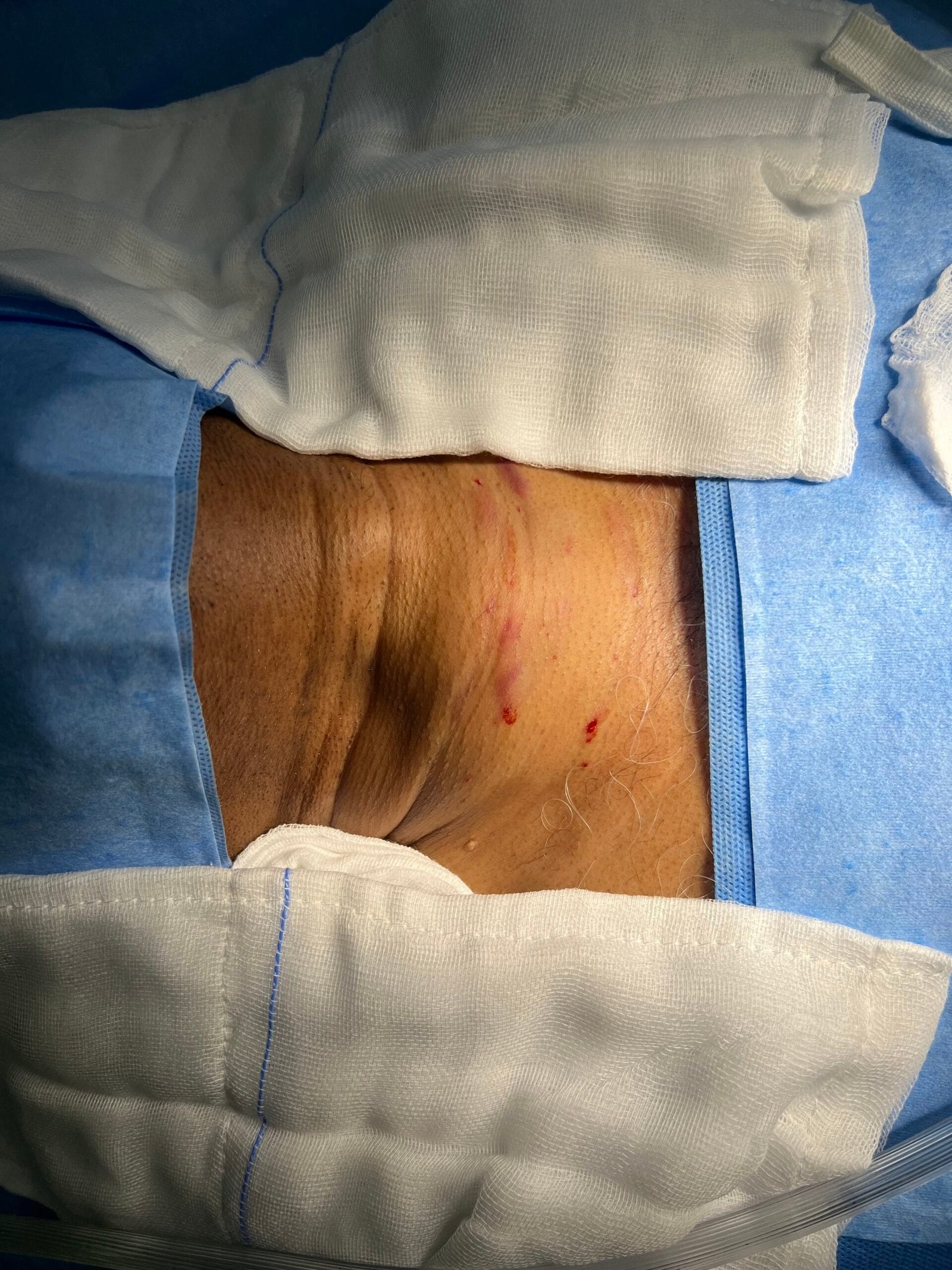 thyroid surgeon